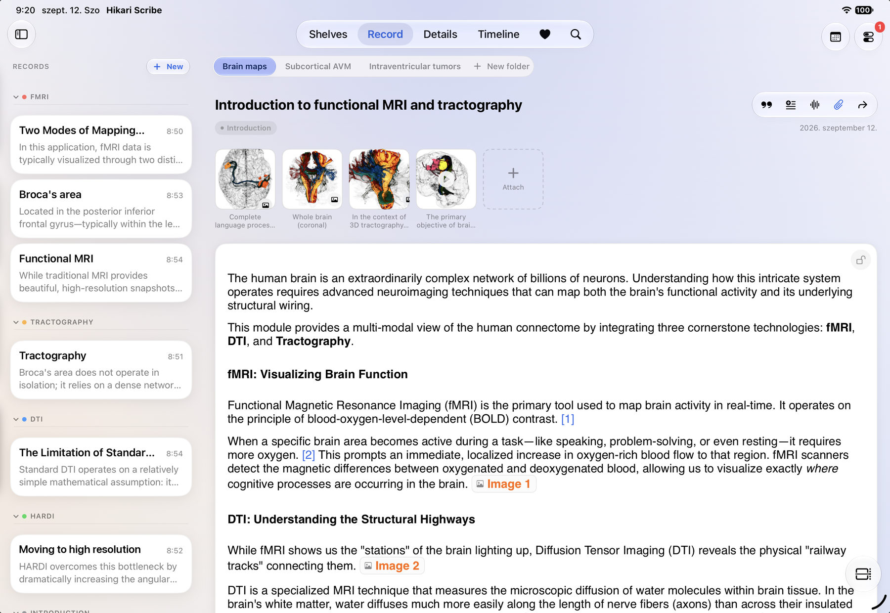 The complete Hikari iPad workspace: a research note beside its records sidebar, folders and attached images.