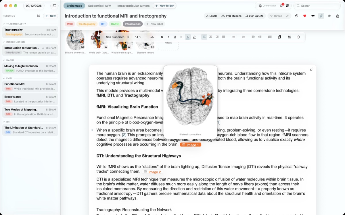 The full Mac window with an attached brain image opened above its paragraph.