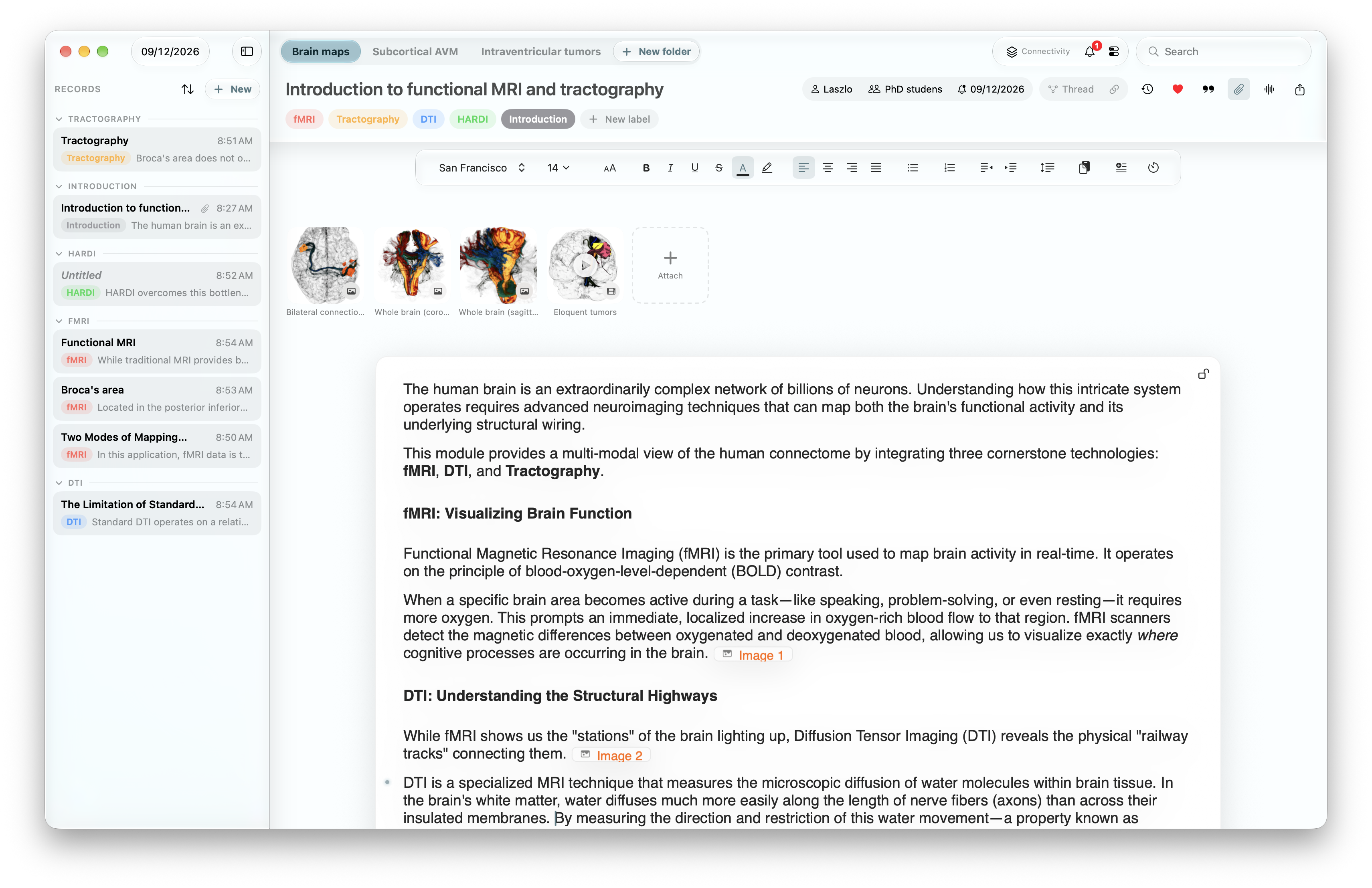 I’m a neurosurgeon and researcher building an app to keep notes and their sources together